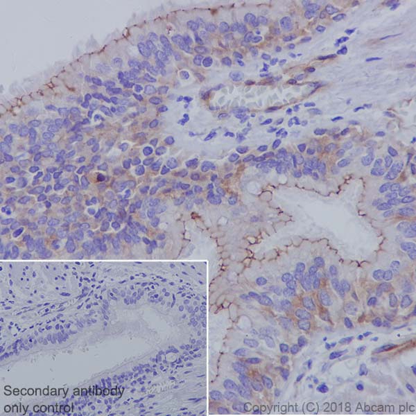 Immunohistochemistry (Formalin/PFA-fixed paraffin-embedded sections) - Anti-ZO1 tight junction protein antibody [EPR19945-224] - BSA and Azide free (AB251567), expandable thumbnail