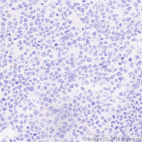 Immunohistochemistry (Formalin/PFA-fixed paraffin-embedded sections) - Anti-ZO1 tight junction protein antibody [EPR19945-224] - BSA and Azide free (ab251567), expandable thumbnail