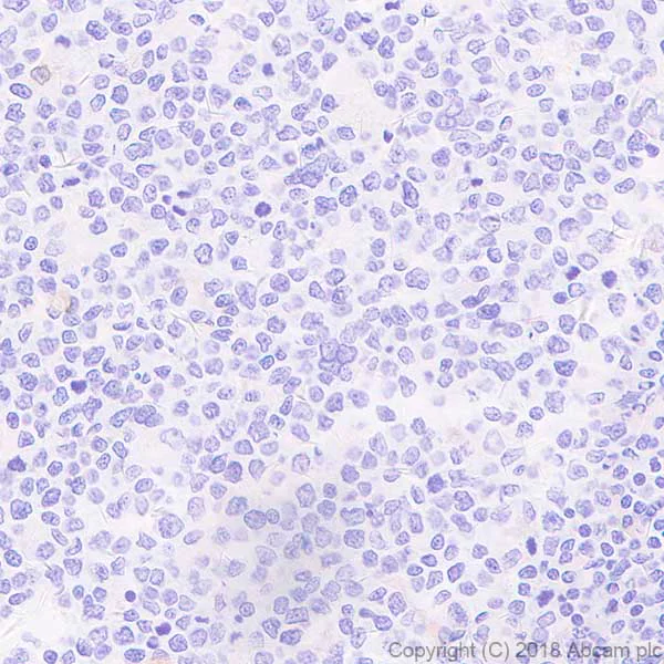 Immunohistochemistry (Formalin/PFA-fixed paraffin-embedded sections) - Anti-ZO1 tight junction protein antibody [EPR19945-224] - BSA and Azide free (AB251567)