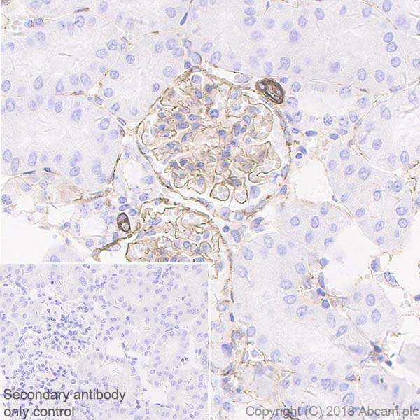 Immunohistochemistry (Formalin/PFA-fixed paraffin-embedded sections) - Anti-ZO1 tight junction protein antibody [EPR19945-296] (ab221547), expandable thumbnail