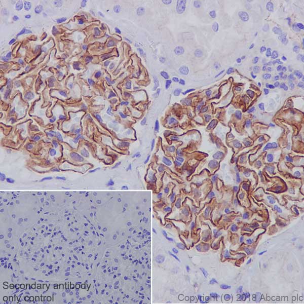 Immunohistochemistry (Formalin/PFA-fixed paraffin-embedded sections) - Anti-ZO1 tight junction protein antibody [EPR19945-296] (AB221547), expandable thumbnail