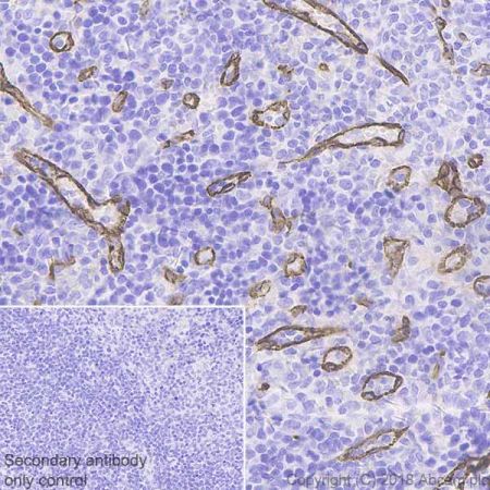 Immunohistochemistry (Formalin/PFA-fixed paraffin-embedded sections) - Anti-ZO1 tight junction protein antibody [EPR19945-296] (AB221547), expandable thumbnail