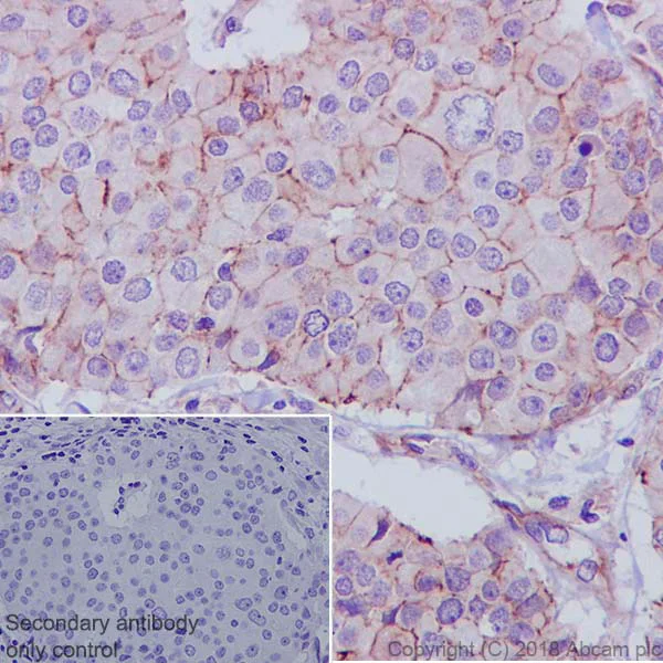 Immunohistochemistry (Formalin/PFA-fixed paraffin-embedded sections) - Anti-ZO1 tight junction protein antibody [EPR19945-296] (AB221547)