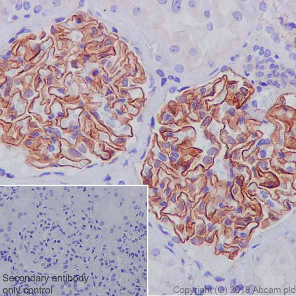 Immunohistochemistry (Formalin/PFA-fixed paraffin-embedded sections) - Anti-ZO1 tight junction protein antibody [EPR19945-296] - BSA and Azide free (AB251568)