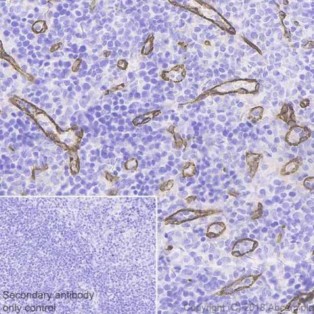 Immunohistochemistry (Formalin/PFA-fixed paraffin-embedded sections) - Anti-ZO1 tight junction protein antibody [EPR19945-296] - BSA and Azide free (AB251568)