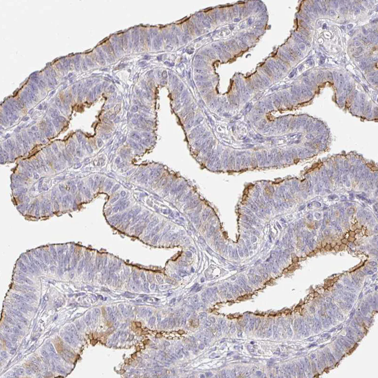 Immunohistochemistry (Formalin/PFA-fixed paraffin-embedded sections) - Anti-Zonula occludens protein 3/ZO3 antibody (AB204231)