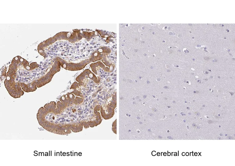 Immunohistochemistry (Formalin/PFA-fixed paraffin-embedded sections) - Anti-Zonula occludens protein 3/ZO3 antibody (AB204231)
