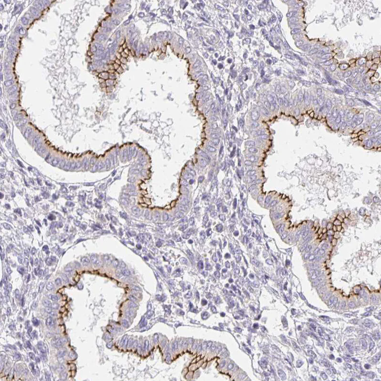 Immunohistochemistry (Formalin/PFA-fixed paraffin-embedded sections) - Anti-Zonula occludens protein 3/ZO3 antibody (AB204231)