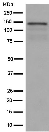 Western blot - Anti-Zonula occludens protein 3/ZO3 antibody [EPR13414-152] (AB182159), expandable thumbnail