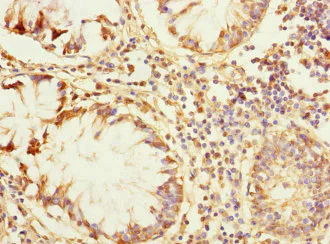 Immunohistochemistry (Formalin/PFA-fixed paraffin-embedded sections) - Anti-ZP2 antibody (AB230219)