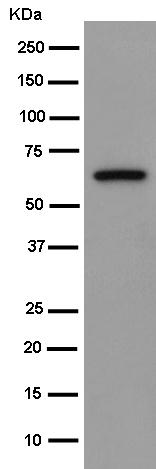 Western blot - Anti-ZP2 antibody [EPR15467] (AB187649), expandable thumbnail