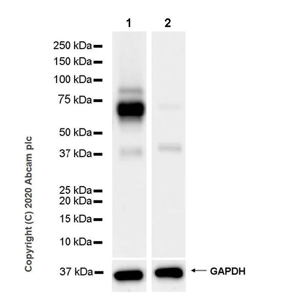 Western blot - Anti-ZPI antibody [EPR23683-118] (AB273627)