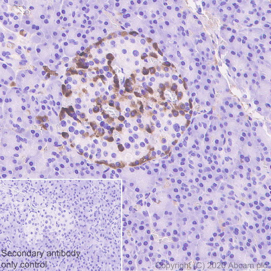 Immunohistochemistry (Formalin/PFA-fixed paraffin-embedded sections) - Anti-ZPI antibody [EPR23683-118] - BSA and Azide free (AB273634)