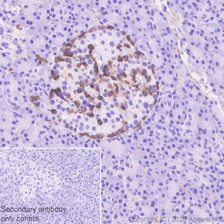 Immunohistochemistry (Formalin/PFA-fixed paraffin-embedded sections) - Anti-ZPI antibody [EPR23683-118] - BSA and Azide free (AB273634)