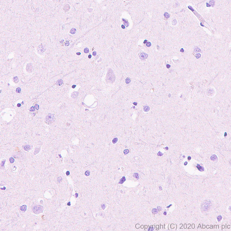 Immunohistochemistry (Formalin/PFA-fixed paraffin-embedded sections) - Anti-ZPI antibody [EPR23683-118] - BSA and Azide free (AB273634)
