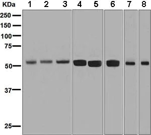 Western blot - Anti-ZPR1 antibody [EPR7595] - BSA and Azide free (AB248762)