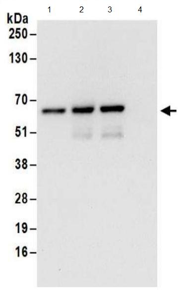 Immunoprecipitation - Anti-ZPR9 antibody (AB174657), expandable thumbnail
