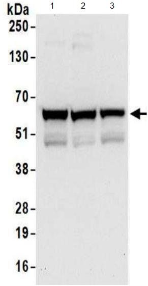 Western blot - Anti-ZPR9 antibody (AB174657), expandable thumbnail