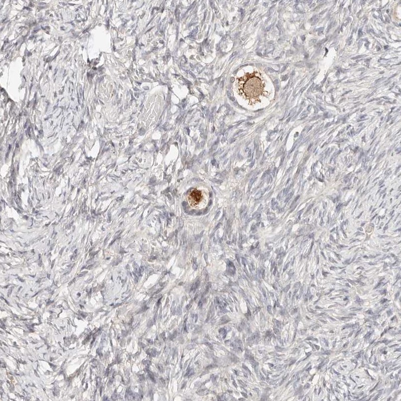 Immunohistochemistry (Formalin/PFA-fixed paraffin-embedded sections) - Anti-ZRANB1 antibody (AB262879), expandable thumbnail