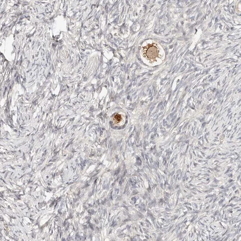 Immunohistochemistry (Formalin/PFA-fixed paraffin-embedded sections) - Anti-ZRANB1 antibody (AB262879)