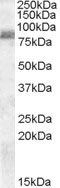 Western blot - Anti-ZRANB1 antibody (AB82132), expandable thumbnail