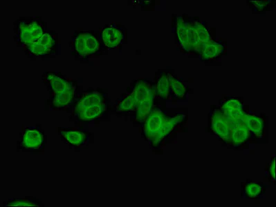 Immunocytochemistry/ Immunofluorescence - Anti-ZRSR2 antibody (AB223062)