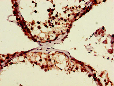 Immunohistochemistry (Formalin/PFA-fixed paraffin-embedded sections) - Anti-ZRSR2 antibody (AB223062)