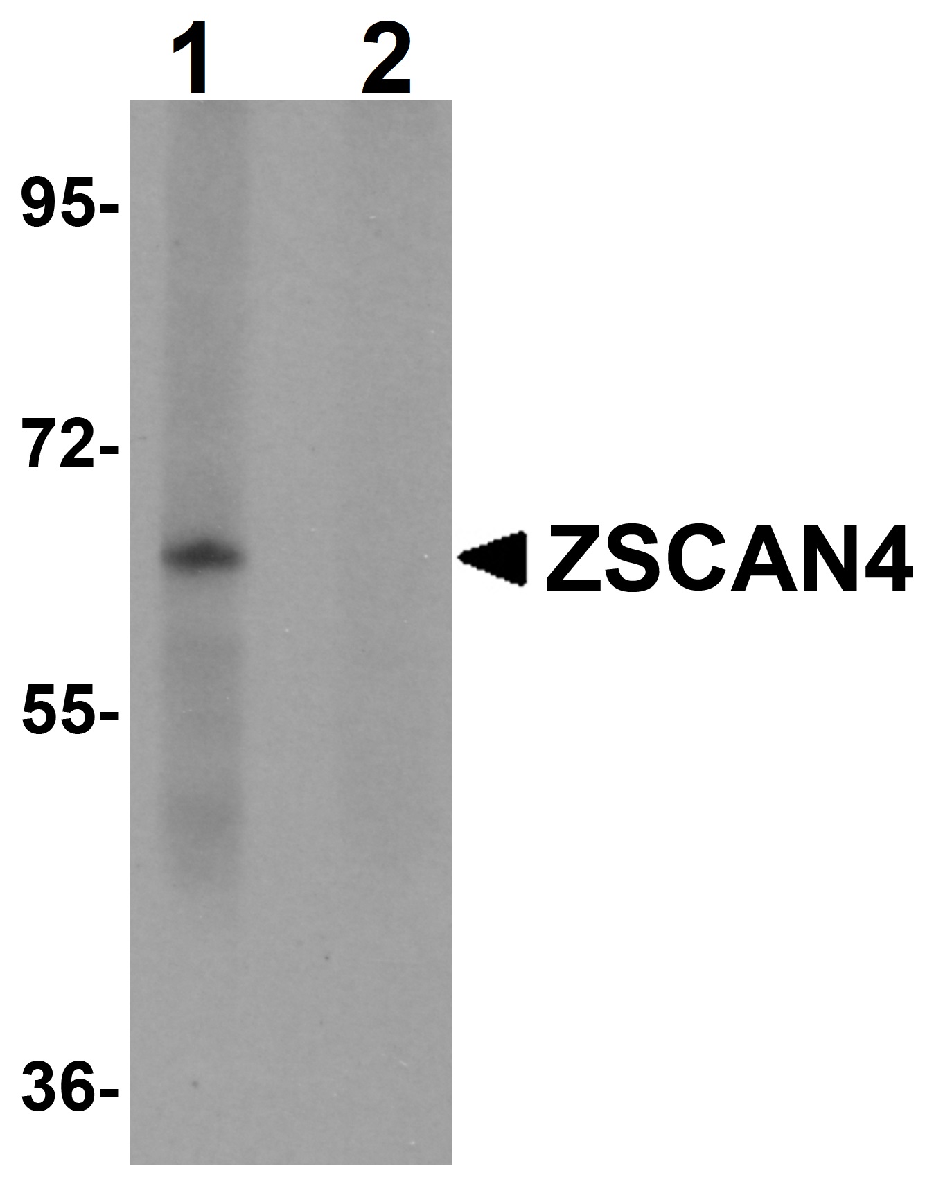 Western blot - Anti-ZSCAN4 antibody (AB106646)