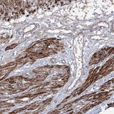 Immunohistochemistry (Formalin/PFA-fixed paraffin-embedded sections) - Anti-ZSWIM6 antibody (AB122301), expandable thumbnail