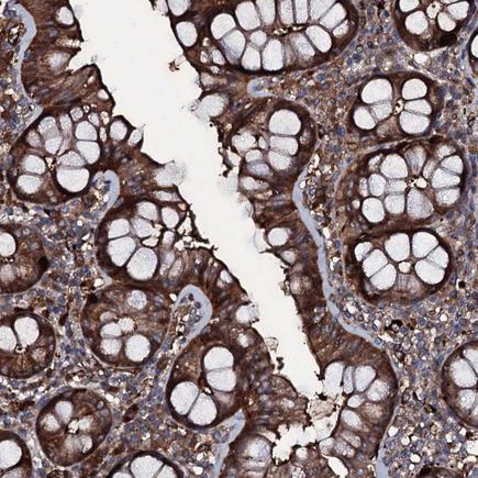 Immunohistochemistry (Formalin/PFA-fixed paraffin-embedded sections) - Anti-ZSWIM8 antibody (AB243442), expandable thumbnail