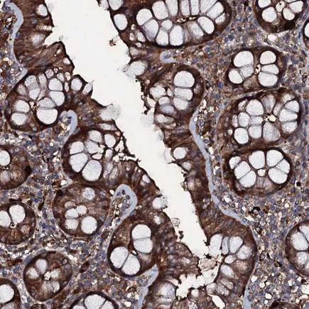 Immunohistochemistry (Formalin/PFA-fixed paraffin-embedded sections) - Anti-ZSWIM8 antibody (AB243442)