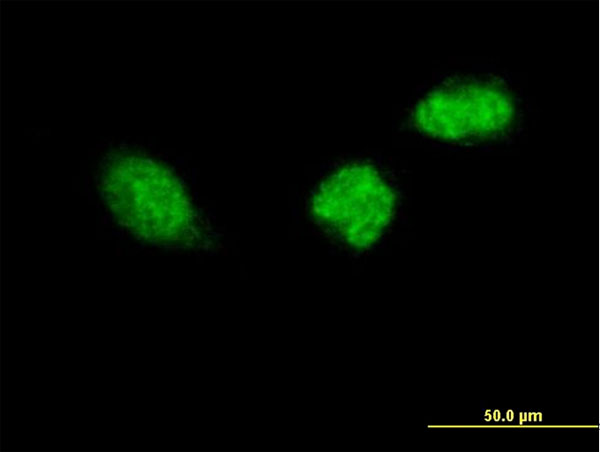 Immunocytochemistry/ Immunofluorescence - Anti-ZWINT antibody (AB168501)