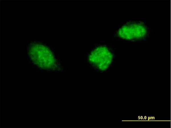 Immunocytochemistry/ Immunofluorescence - Anti-ZWINT antibody (AB168501)