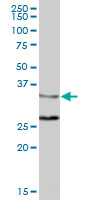 Western blot - Anti-ZWINT antibody (AB168501)
