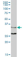 Western blot - Anti-ZWINT antibody (AB168501)