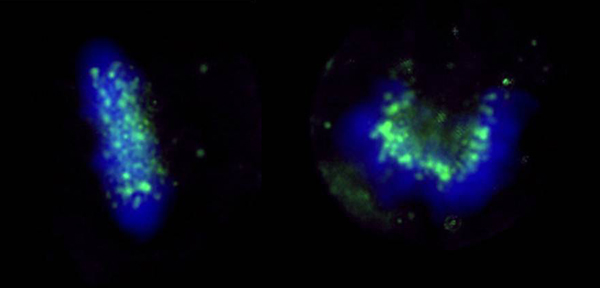 Immunocytochemistry/ Immunofluorescence - Anti-ZWINT antibody (AB71982)