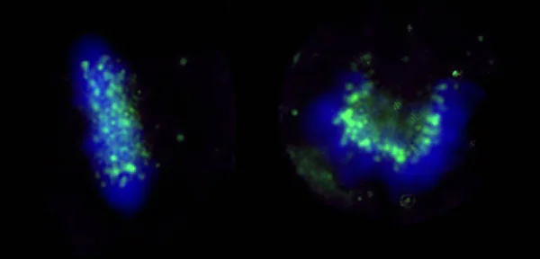 Immunocytochemistry/ Immunofluorescence - Anti-ZWINT antibody (AB71982)