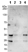 Western blot - Anti-ZWINT antibody (AB71982)