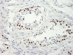 Immunohistochemistry (Formalin/PFA-fixed paraffin-embedded sections) - Anti-ZWINT antibody (AB84367)