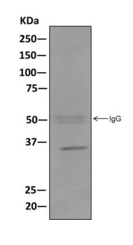 Immunoprecipitation - Anti-ZWINT antibody [EPR10905] - BSA and Azide free (AB249777)