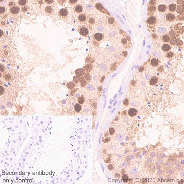 Immunohistochemistry (Formalin/PFA-fixed paraffin-embedded sections) - Anti-ZWINT antibody [EPR23440-96] - BSA and Azide free (AB273052)