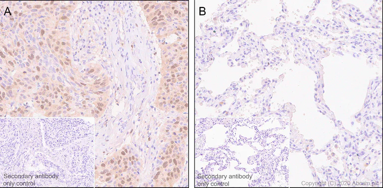 Immunohistochemistry (Formalin/PFA-fixed paraffin-embedded sections) - Anti-ZWINT antibody [EPR23440-96] - BSA and Azide free (AB273052)