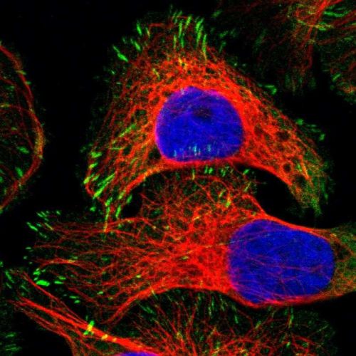 Immunocytochemistry/ Immunofluorescence - Anti-Zyxin antibody (AB244277), expandable thumbnail