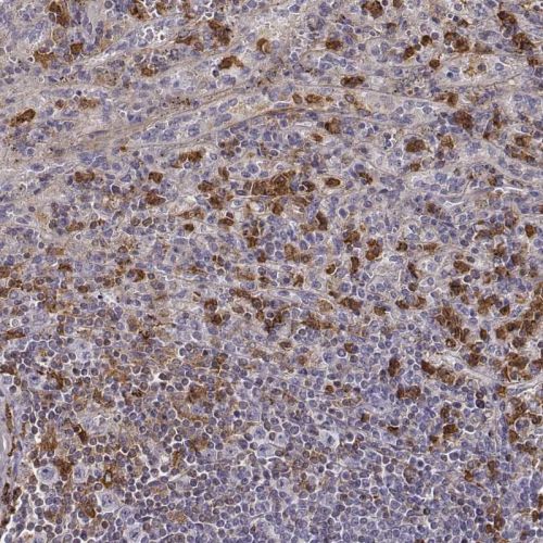 Immunohistochemistry (Formalin/PFA-fixed paraffin-embedded sections) - Anti-Zyxin antibody (AB244277), expandable thumbnail