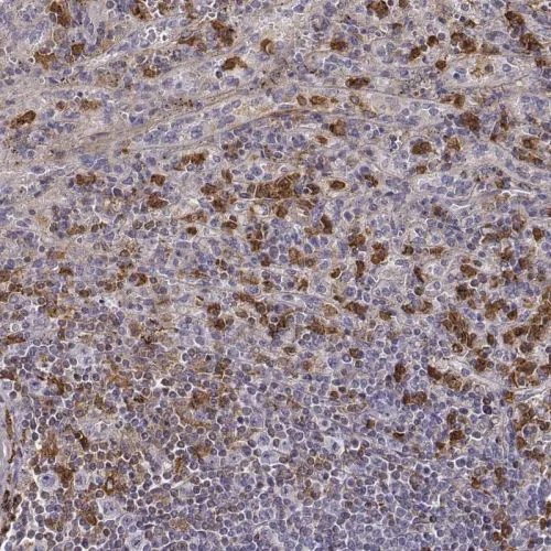 Immunohistochemistry (Formalin/PFA-fixed paraffin-embedded sections) - Anti-Zyxin antibody (AB244277)