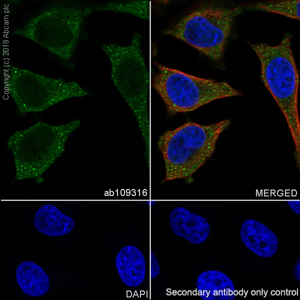 Anti-Zyxin antibody [EPR4302] (ab109316) | Abcam