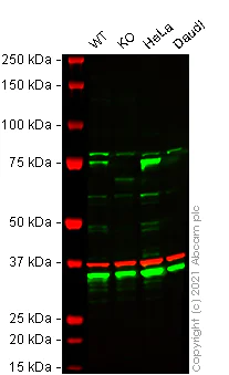 Western blot - Anti-Zyxin antibody [EPR4302] (AB109316)