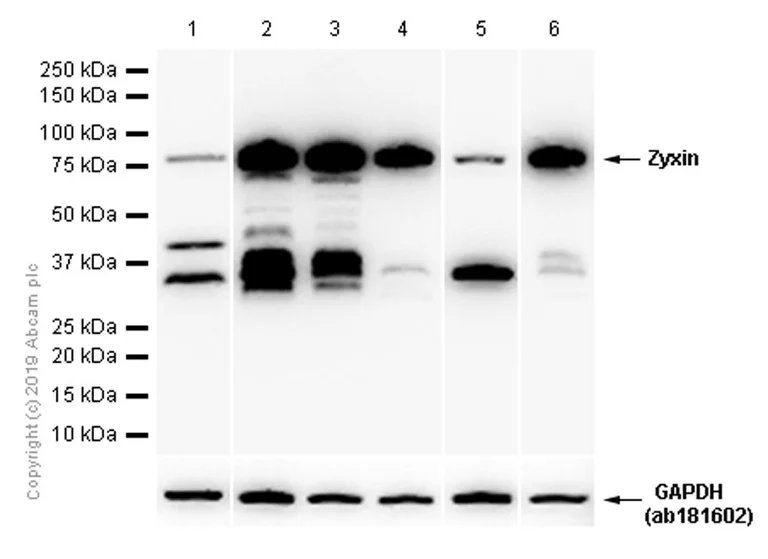 Western blot - Anti-Zyxin antibody [EPR4302] (AB109316)