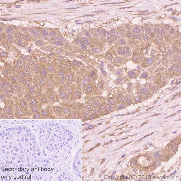 Immunohistochemistry (Formalin/PFA-fixed paraffin-embedded sections) - Anti-Zyxin antibody [EPR4302] - BSA and Azide free (AB238430), expandable thumbnail