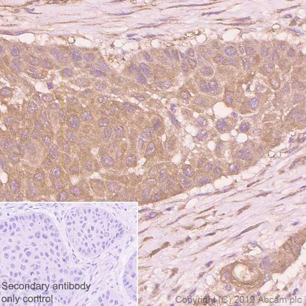 Immunohistochemistry (Formalin/PFA-fixed paraffin-embedded sections) - Anti-Zyxin antibody [EPR4302] - BSA and Azide free (AB238430)